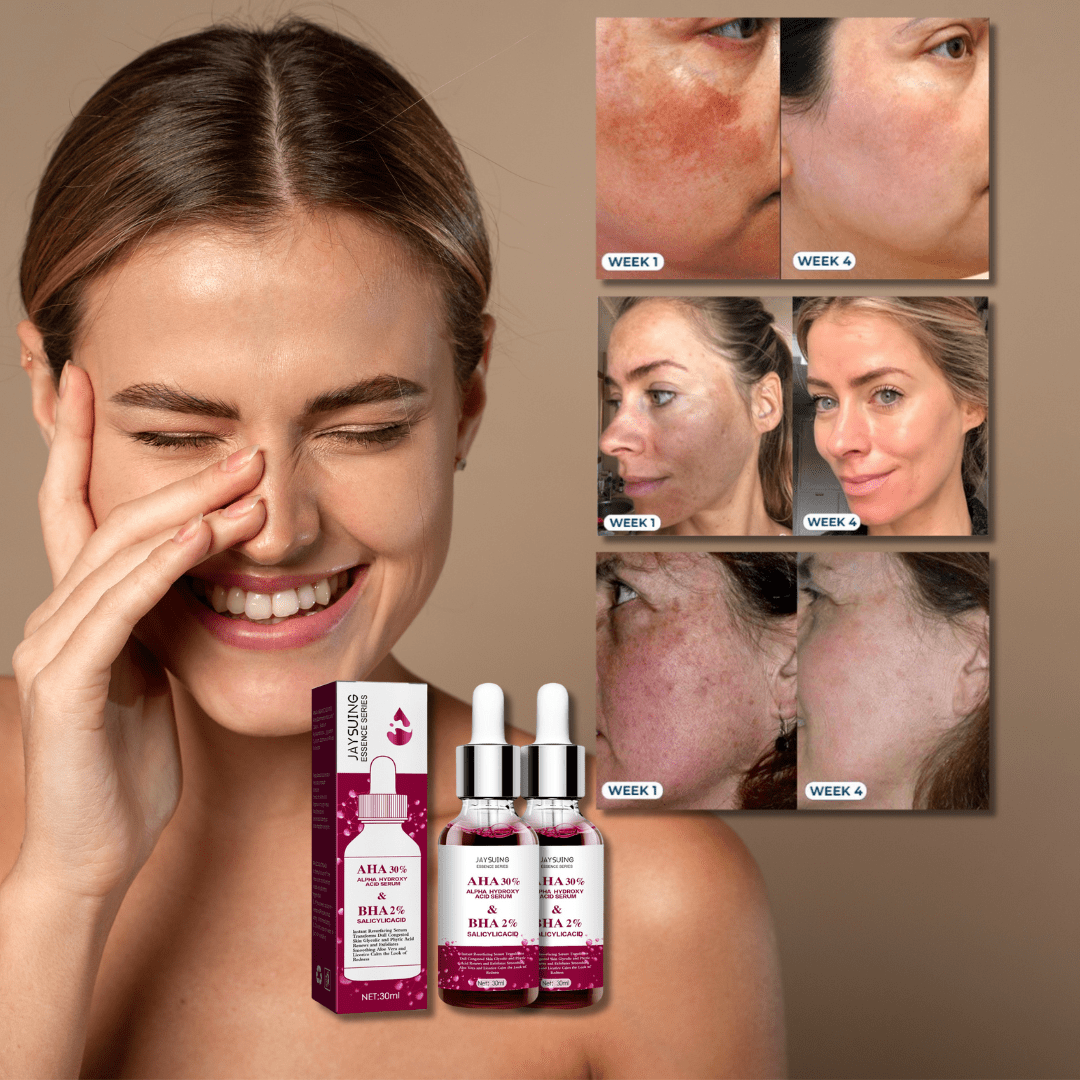 Anti-Melasma Face Serum Kit - (Buy 1 and Receive 2) - Black Friday 60% OFF